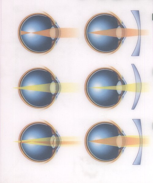 Eyes.jpg (40442 bytes)
